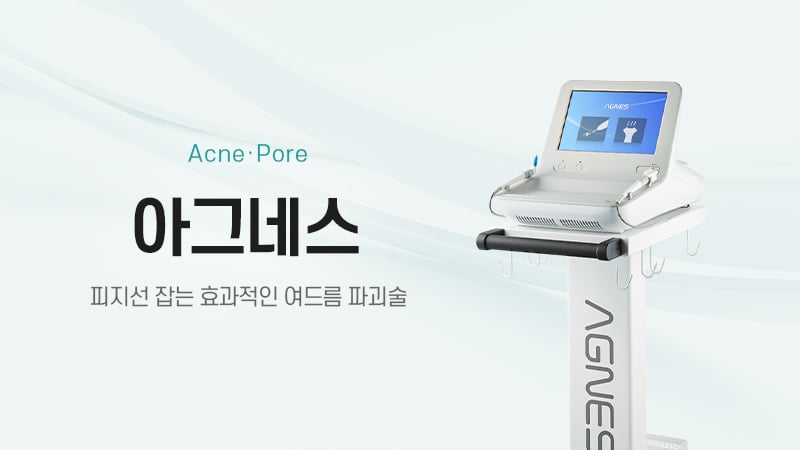 아그네스