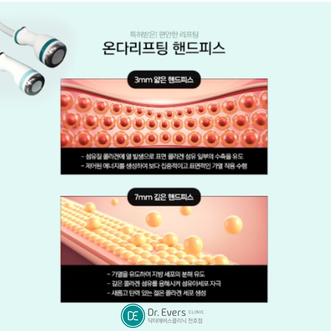 바디 온다리프팅 천호피부과 닥터에버스