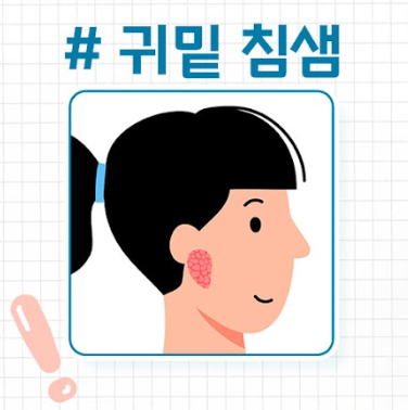 침샘보톡스 천호피부과 닥터에버스 침샘보톡스 천호피부과 닥터에버스