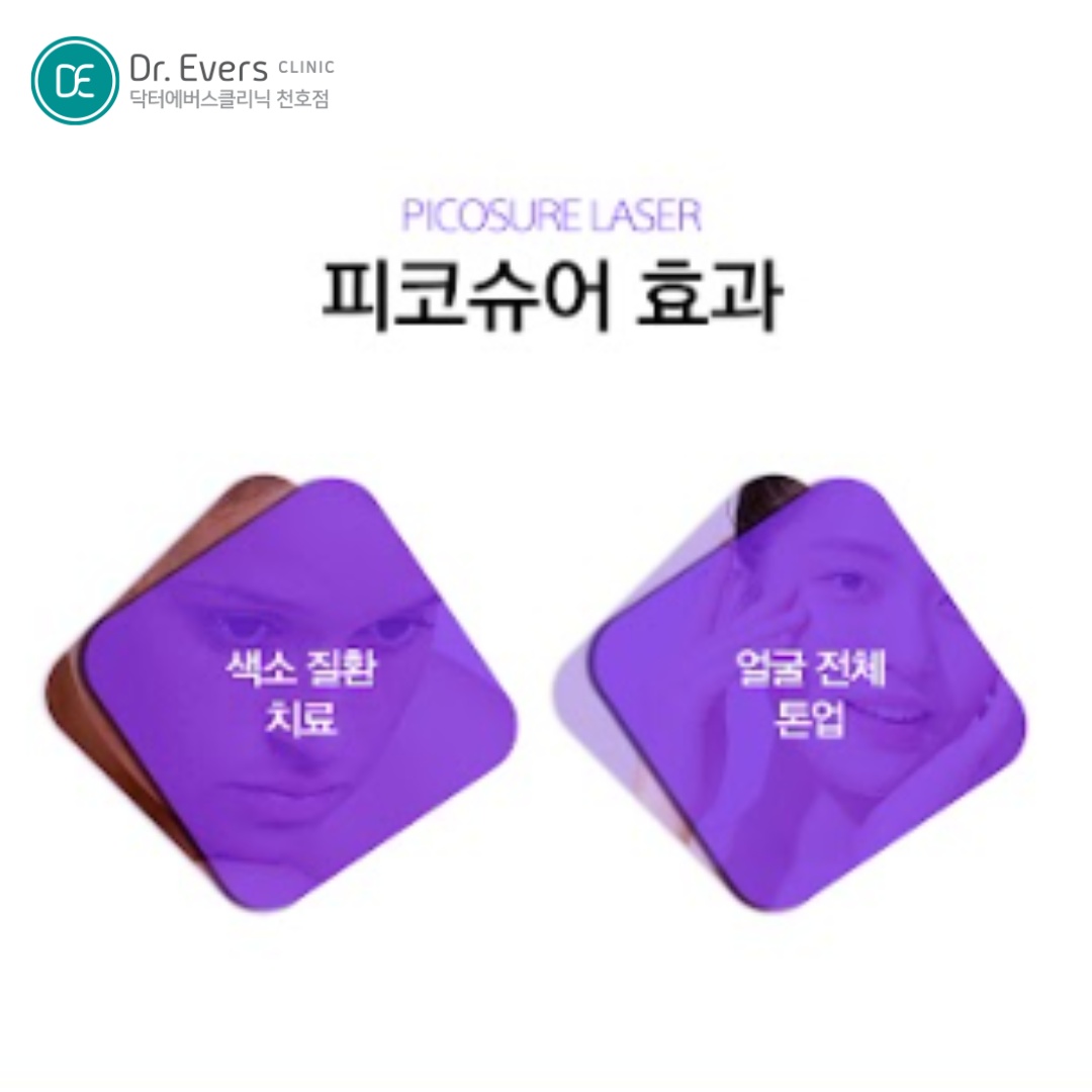 피코슈어토닝 천호피부과 닥터에버스 피코슈어토닝 천호피부과 닥터에버스